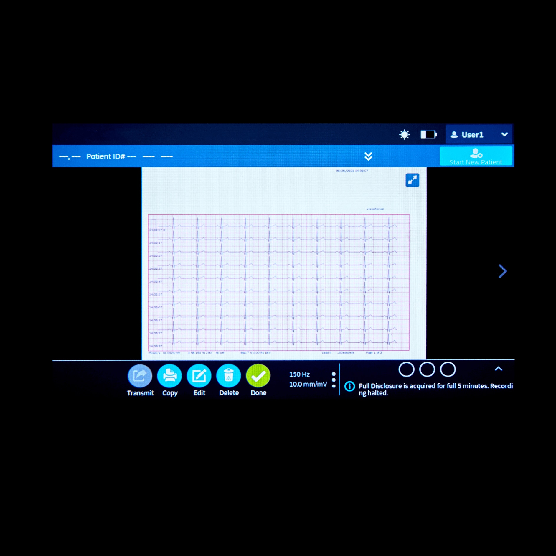 MAC™ 5 Lite Resting ECG MAC™ 5 Lite Resting ECG