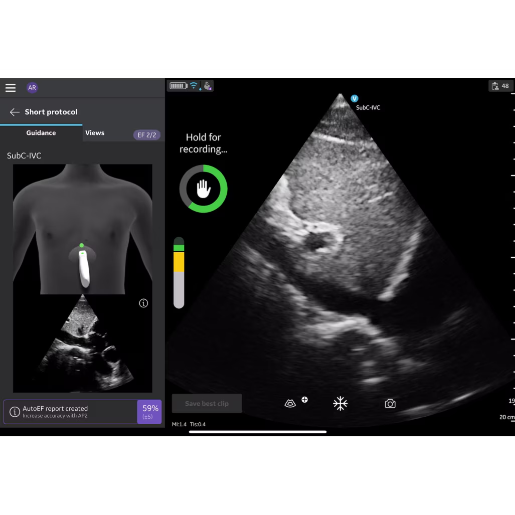 Caption AI™ for Vscan Air™ SL