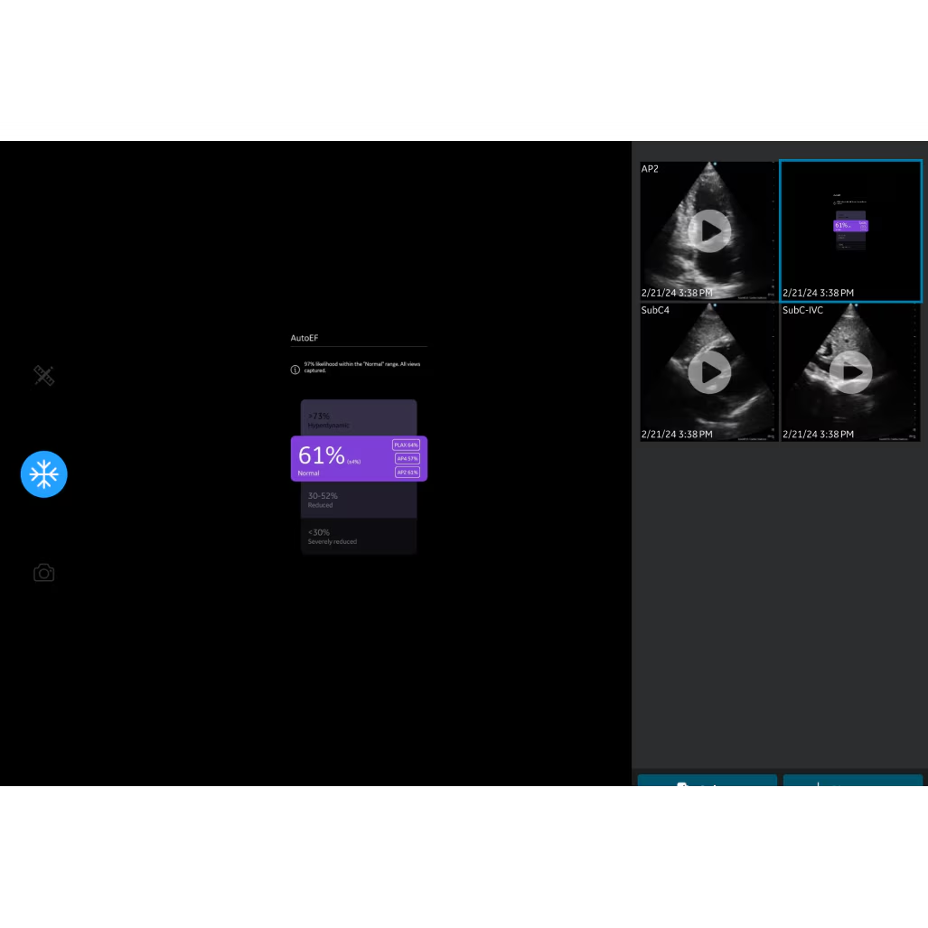 Caption AI™ for Vscan Air™ SL
