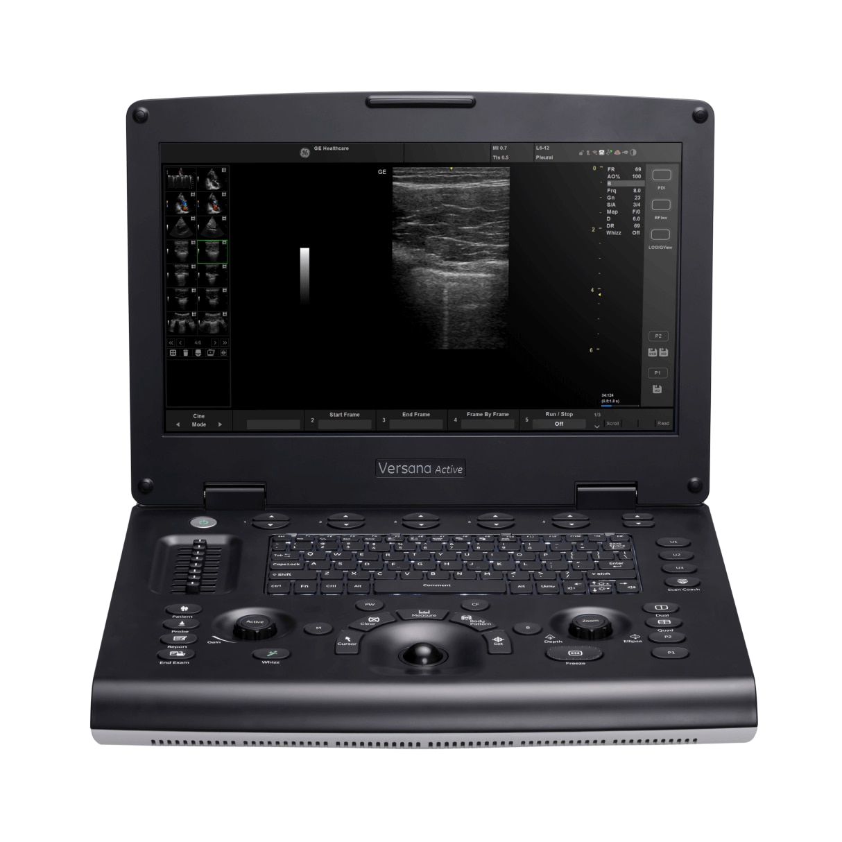 Versana Active™ Versana Active™